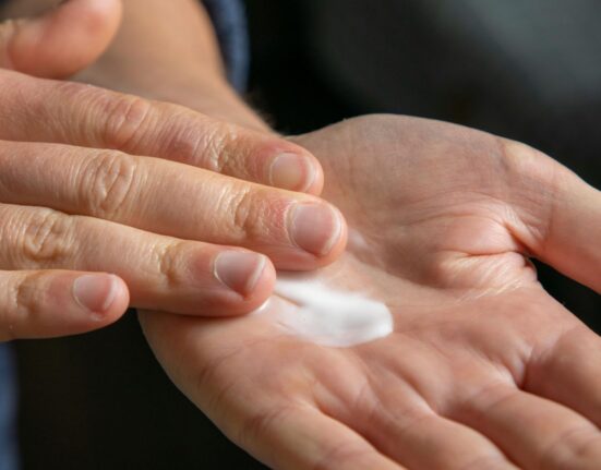 Hydroquinone Tretinoin Mometasone Cream