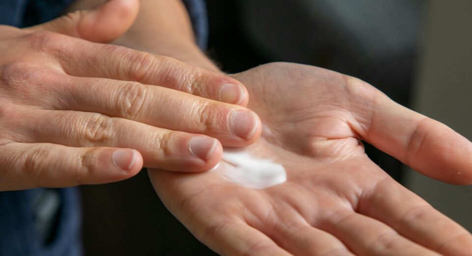 Hydroquinone Tretinoin Mometasone Cream